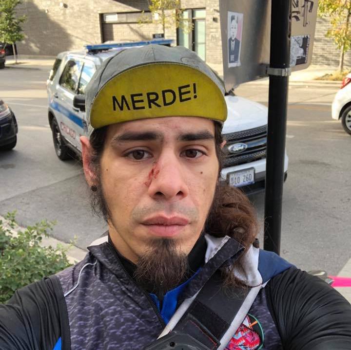 Brian Bauer, after the attack.